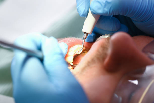 Best Emergency Dental Care for Sports Injuries in Sandston, VA
